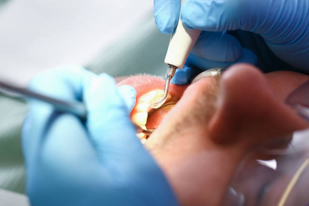 Professional Emergency Dental Service in TN