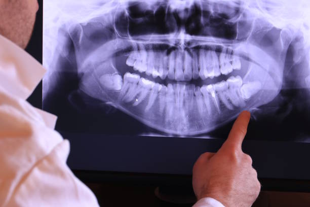 Best Emergency Wisdom Tooth Extraction in White House, TN